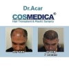 Cosmedica Dr.Acar HairTransplant & Esthetics