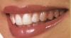 Split Dent Dental Care